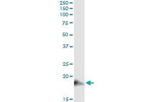 Immunoprecipitation of BST2 transfected lysate using anti-BST2 monoclonal antibody and Protein A Magnetic Bead , and immunoblotted with BST2 MaxPab rabbit polyclonal antibody. (BST2 抗体  (AA 1-180))