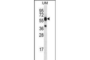LI Antibody (C-term) (ABIN656461 and ABIN2845745) western blot analysis in uterus tumor cell line lysates (35 μg/lane). (LIPM 抗体  (C-Term))