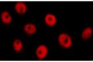 ABIN6277733 staining  Hela cells by IF/ICC. (RAD21 抗体  (C-Term))
