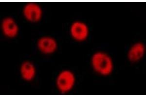 ABIN6277733 staining  Hela cells by IF/ICC. (RAD21 抗体  (C-Term))