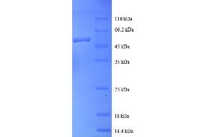 SDS-PAGE (SDS) image for RAB1A, Member RAS Oncogene Family (RAB1A) (AA 2-205) protein (GST tag) (ABIN5712049) (RAB1A Protein (AA 2-205) (GST tag))
