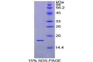 SDS-PAGE (SDS) image for Calmodulin 1 (Calm1) (AA 1-149) protein (His tag) (ABIN1079029)