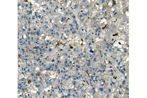 IHC analysis of AKR1D1 using anti-AKR1D1 antibody (ABIN7602741). (AKR1D1 抗体  (C-Term))