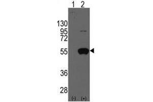 Image no. 1 for anti-Aldehyde Dehydrogenase 2 Family (Mitochondrial) (ALDH2) (N-Term) antibody (ABIN356917) (ALDH2 抗体  (N-Term))