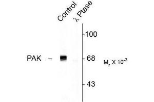 Image no. 1 for anti-P21-Activated Kinase 1 (PAK1) (pThr402) antibody (ABIN372696) (PAK1 抗体  (pThr402))