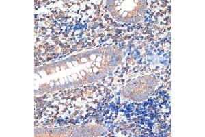 Immunohistochemistry of paraffin-embedded human appendix using CRMP5/DPYSL5 Rabbit mAb (ABIN7266774) at dilution of 1:100 (40x lens). (DPYSL5 抗体)