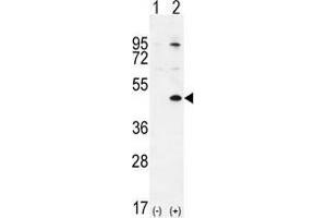 Western blot analysis of TGIF1 (arrow) using rabbit polyclonal TGIF1 Antibody (Center L223) . (TGIF1 抗体  (Middle Region))