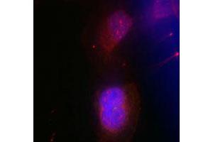 Immunofluorescence staining of methanol-fixed HeLa cells using BRCA1 (phospho S988) polyclonal antibody (Cat # PAB12267, red).