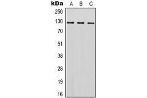 Western blot analysis of SREBP1 expression in Hela (A), Jurkat (B), NIH3T3 (C) whole cell lysates. (SREBF1 抗体)