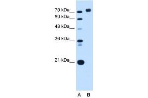 PTPRN antibody used at 0. (PTPRN 抗体  (Middle Region))