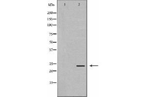 Western blot analysis of Hela whole cell lysates, using MAD2L1 Antibody.