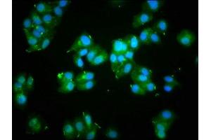 Immunofluorescence staining of HepG2 cells with ABIN7139708 at 1:133, counter-stained with DAPI. (Actin 抗体  (AA 7-377))