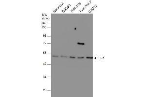 WB Image Various whole cell extracts (30 μg) were separated by 10% SDS-PAGE, and the membrane was blotted with ILK antibody [N1C1] , diluted at 1:500.