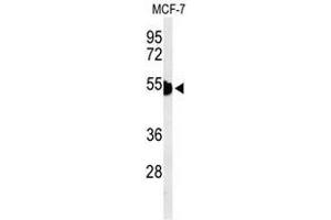 Western blot analysis of KRT1 Antibody (Center) in MCF-7 cell line lysates (35µg/lane). (Cytokeratin 1 抗体  (Middle Region))