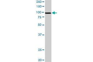 PDCD6IP MaxPab rabbit polyclonal antibody. (ALIX 抗体  (AA 1-868))