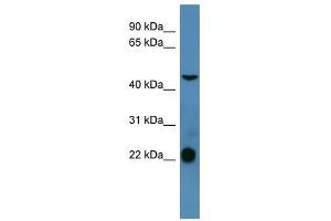 SSTR1 antibody used at 0. (SSTR1 抗体  (C-Term))