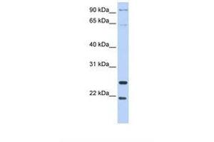 Image no. 1 for anti-Granzyme A (Granzyme 1, Cytotoxic T-Lymphocyte-Associated serine Esterase 3) (GZMA) (AA 110-159) antibody (ABIN6738997)