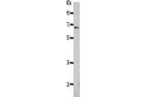 Gel: 10 % SDS-PAGE, Lysate: 40 μg, Lane: Mouse eyes tissue, Primary antibody: ABIN7189978(BEST1 Antibody) at dilution 1/300, Secondary antibody: Goat anti rabbit IgG at 1/8000 dilution, Exposure time: 2 minutes (Bestrophin 1 抗体)