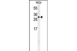 TM2D3 Antibody (N-term) (ABIN651559 and ABIN2840300) western blot analysis in WiDr cell line lysates (35 μg/lane). (TM2D3 抗体  (N-Term))