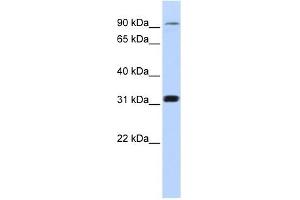 Cyclin M4 antibody used at 1 ug/ml to detect target protein. (CNNM4 抗体  (Middle Region))