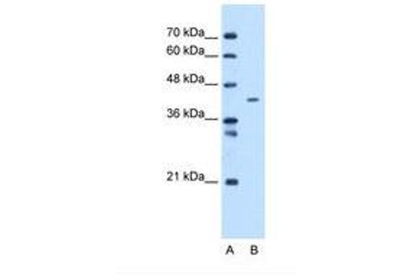 MTCH1 抗体  (C-Term)