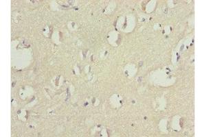 Immunohistochemistry of paraffin-embedded human brain tissue using ABIN7165175 at dilution of 1:100 (TNRC5 抗体  (AA 31-278))