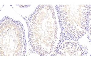 Detection of MAP2 in Rat Testis Tissue using Polyclonal Antibody to Microtubule Associated Protein 2 (MAP2) (MAP2 抗体  (AA 1459-1718))