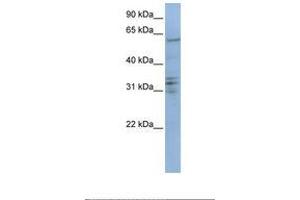Image no. 1 for anti-Centromere Protein B (CENPB) (AA 506-555) antibody (ABIN6738799) (CENPB 抗体  (AA 506-555))