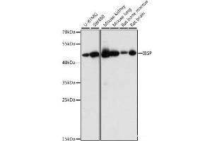 Western blot analysis of extracts of various cell lines using IBSP Polyclonal Antibody at dilution of 1:1000. (IBSP 抗体)