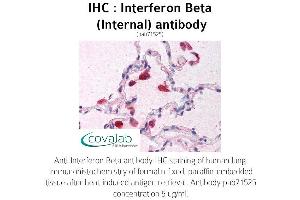 Image no. 1 for anti-Interferon, beta 1, Fibroblast (IFNB1) (Internal Region) antibody (ABIN1735973) (IFNB1 抗体  (Internal Region))