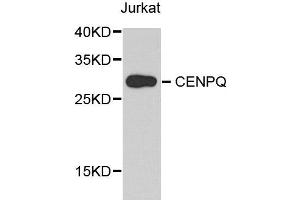 Western blot analysis of extract of various cells, using CENPQ antibody. (CENPQ 抗体)