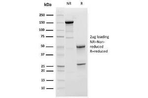 SDS-PAGE Analysis Purified C1QA Mouse Monoclonal Antibody (C1QA/2952). (C1QA 抗体  (AA 104-237))