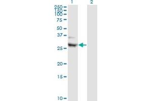 Western Blot analysis of CIDEA expression in transfected 293T cell line by CIDEA monoclonal antibody (M01), clone 4B9. (CIDEA 抗体  (AA 1-253))