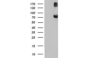 Western Blotting (WB) image for anti-F-Box Protein 21 (FBXO21) antibody (ABIN1498238) (FBXO21 抗体)