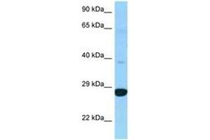 Image no. 1 for anti-Dehydrogenase/reductase (SDR Family) Member 4 Like 2 (DHRS4L2) (C-Term) antibody (ABIN6748237) (DHRS4L2 抗体  (C-Term))