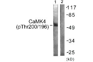 Immunohistochemistry analysis of paraffin-embedded human brain tissue using CaMK4 (Phospho-Thr196/200) antibody. (CAMK4 抗体  (pThr196, pThr200))
