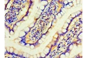 Immunohistochemistry of paraffin-embedded human small intestine tissue using ABIN7156569 at dilution of 1:100 (IFNA4 抗体  (AA 24-189))