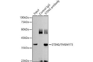 Immunoprecipitation (IP) image for anti-Transmembrane Protein 173 (TMEM173) (AA 170-379) antibody (ABIN1683049)
