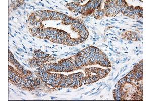 Immunohistochemical staining of paraffin-embedded Human liver tissue using anti-KHK mouse monoclonal antibody. (Ketohexokinase 抗体)