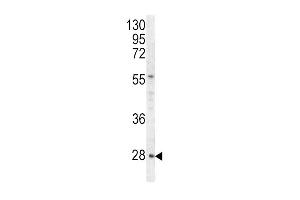 Western blot analysis of HPRT1 antibody (C-term) (ABIN390692 and ABIN2840982) in Hela cell line lysates (35 μg/lane). (HPRT1 抗体  (C-Term))