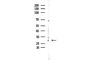 anti-Isopentenyl-Diphosphate delta Isomerase 1 (IDI1) (N-Term) antibody