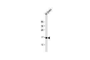 Anti-CPLX1 Antibody (Center) at 1:1000 dilution + mouse brain lysate Lysates/proteins at 20 μg per lane. (Complexin 1 抗体  (AA 33-60))