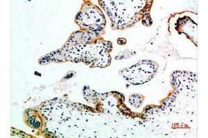 Immunohistochemical analysis of paraffin-embedded human-placenta, antibody was diluted at 1:200