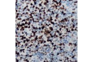 Immunohistochemical analysis of CCNB1IP1 staining in human lymph node formalin fixed paraffin embedded tissue section. (CCNB1IP1 抗体  (C-Term))