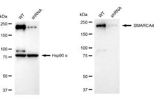 Western blotting analysis using SMARCA4 antibody (ABIN7800476).