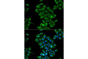 Immunofluorescence analysis of HeLa cells using CTNS antibody. (CTNS 抗体)