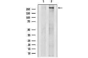 Western blot analysis of lysates from EC304 cells, using TRRAP Antibody.