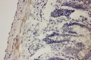 Immunohistochemistry (IHC) image for anti-Prostaglandin-Endoperoxide Synthase 1 (Prostaglandin G/H Synthase and Cyclooxygenase) (PTGS1) (AA 318-599) antibody (ABIN3042528)
