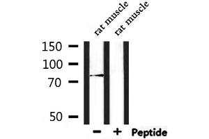 anti-Leucine Rich Repeat and Sterile alpha Motif Containing 1 (LRSAM1) (Internal Region) antibody