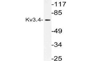 Western blot (WB) analysis of Kv3. (Kv3.4 抗体)